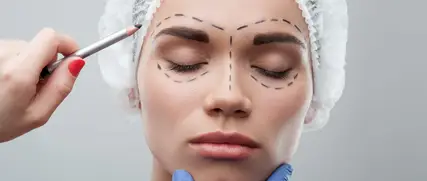 Blépharoplastie Chirurgie des paupières